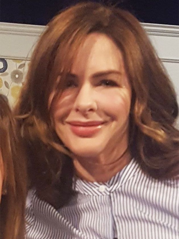 trinny-woodall-8217-s-changing-face-i-8217-ve-been-having-botox-for-years